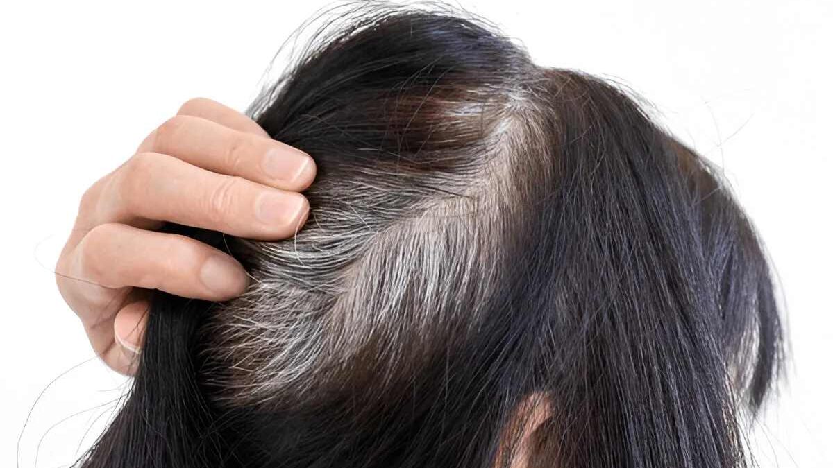 Wellhealthorganic.com How to Prevent White Hair Naturally