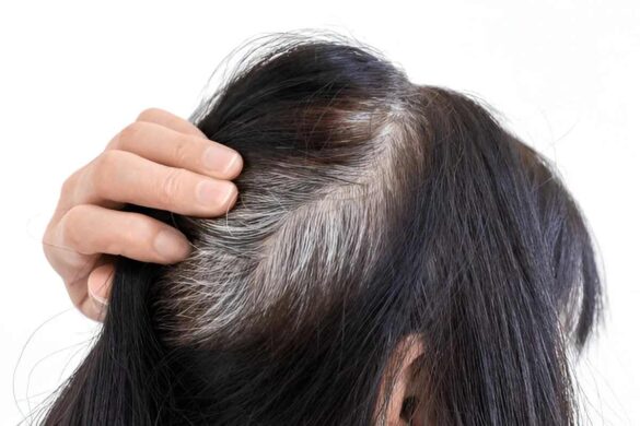 Wellhealthorganic.com How to Prevent White Hair Naturally